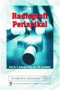 RADIOGRAFI PERIAPIKAL